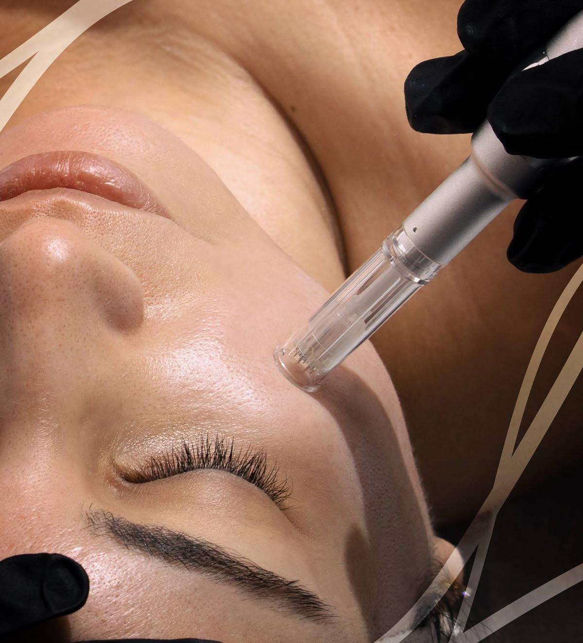 ✨﻿﻿Découvrez le microneedling avec KRX Aesthetics chez Maison S : la beauté coréenne au service de votre peau 🇰🇷﻿